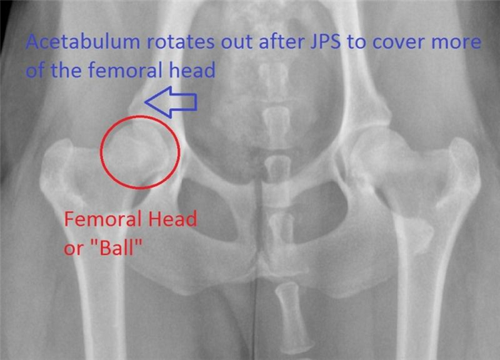 Рентгеновский снимок операции JPS