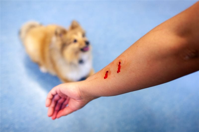 Собаки могут быть подвергнуты эвтаназии за укус
